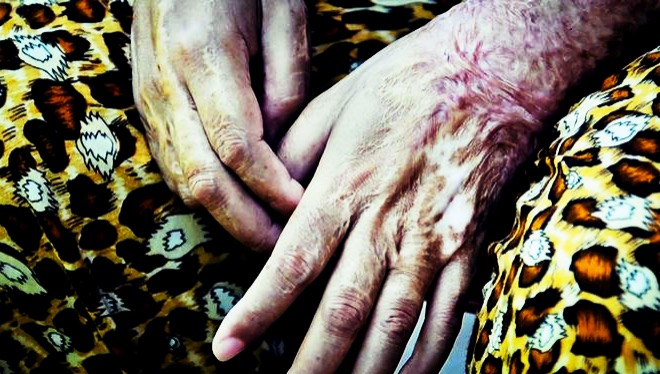 دو مجروح بر اثر اسیدپاشی در استان سمنان