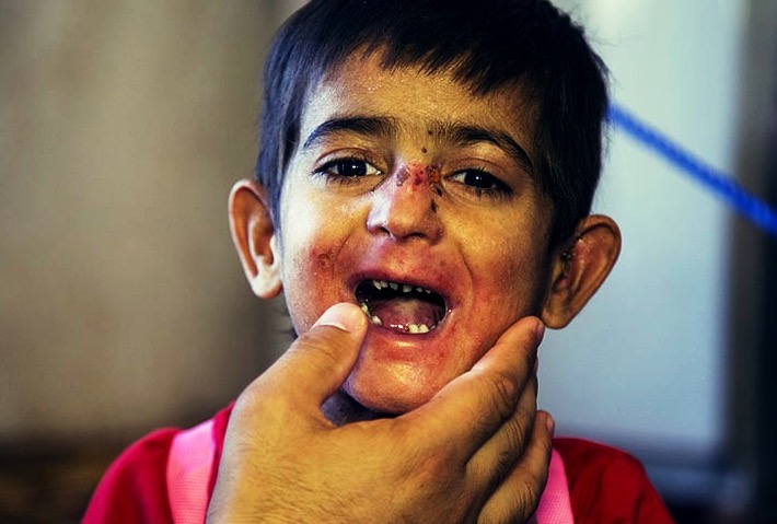 مرگ خاموش کودکان جنوب کرمان/ گزارش تصویری
