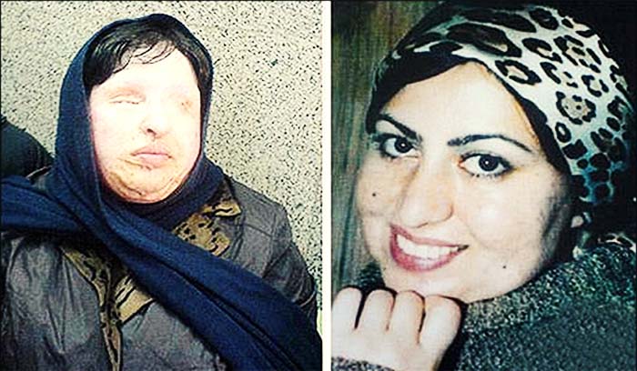 عمل نشدن آمنه بهرامی به دلیل عدم پرداخت‌ فاکتور چهار ساله بیمارستان توسط سفارت ایران