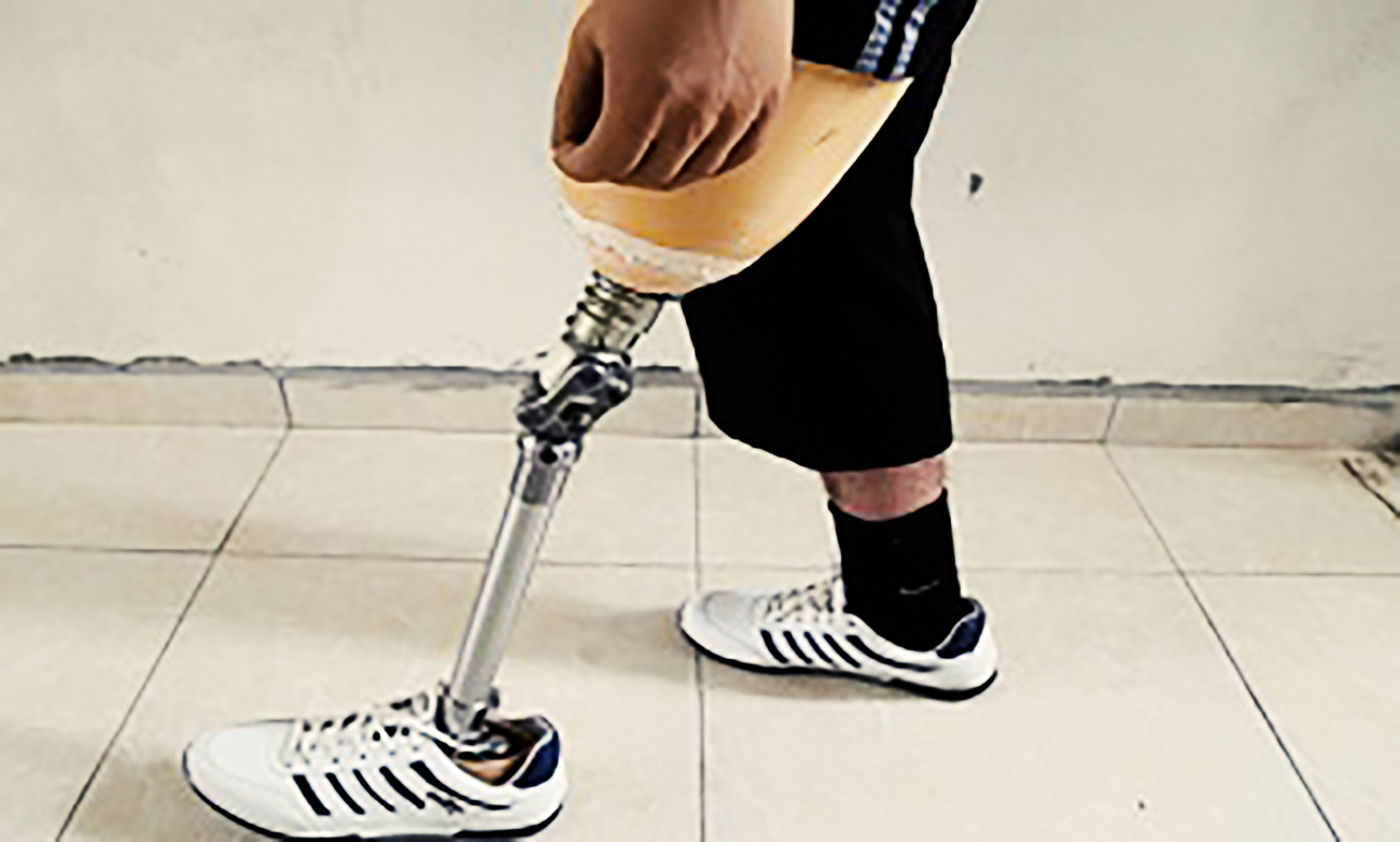 اخراج یک معلول از استخری در تهران به علت نداشتن پا