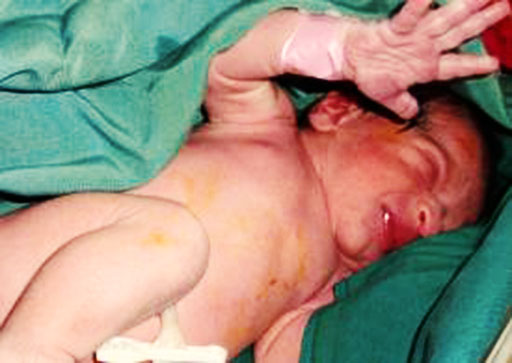 عدم پذیرش نوزاد یک روزه رها شده در پدیده شاندیز از سوی نهادهای دولتی