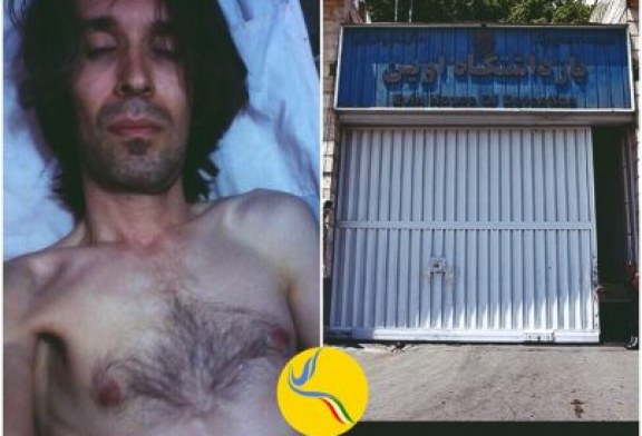 تداوم وضعیت نامساعد جسمانی آرش صادقی در زندان اوین